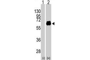 Western blot analysis of MYC (arrow) using MYC polyclonal antibody . (c-MYC Antikörper  (Thr58))