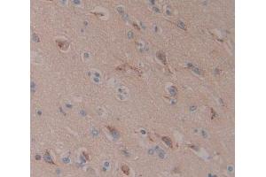 IHC-P analysis of Kidney tissue, with DAB staining.