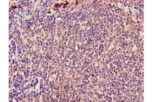 Immunohistochemistry of paraffin-embedded human lymph node tissue using ABIN7145576 at dilution of 1:100 (ATIC Antikörper  (AA 301-592))