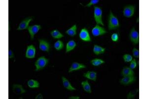 Immunofluorescence staining of A549 cells with ABIN7166074 at 1:133, counter-stained with DAPI. (S1A9 (AA 2-114) Antikörper)