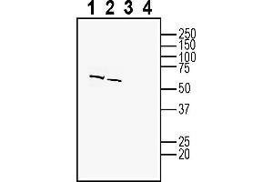 Western blot analysis of human LNCaP prostate adenocarcinoma cell line lysate (lanes 1 and 3) and human SH-SY5Y neuroblastoma cell line lysates (lanes 2 and 4):1-2.