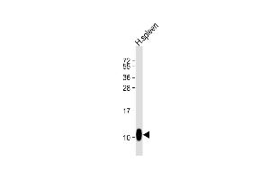 Anti-BP Antibody (C-term) at 1:1000 dilution + human spleen lysate Lysates/proteins at 20 μg per lane.