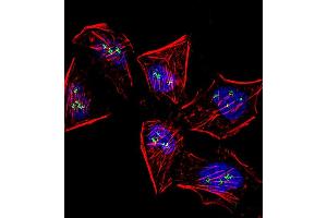 Fluorescent confocal image of Hela cell stained with Meox1 (Human N-term) (ABIN391406 and ABIN2841406). (MEOX1 Antikörper  (N-Term))