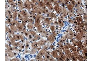 Image no. 4 for anti-Adenylate Kinase 5 (AK5) antibody (ABIN1496535) (Adenylate Kinase 5 Antikörper)