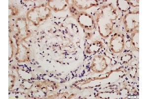 Formalin-fixed and paraffin embedded human kidney tissue labeled with Rabbit Anti-IRF9 Polyclonal Antibody, Unconjugated (ABIN2177064) at 1:200 followed by conjugation to the secondary antibody and DAB staining