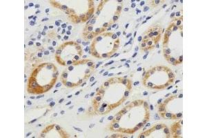 Immunohistochemistry (IHC) image for anti-Phosphoglycerate Kinase 1 (PGK1) (AA 117-145) antibody (ABIN3032224)