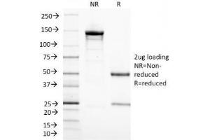 SDS-PAGE (SDS) image for anti-CD3 epsilon (CD3E) (AA 23-119) antibody (ABIN4949514)