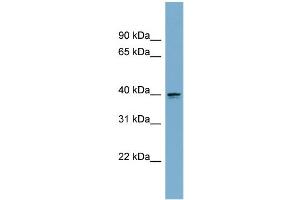 WB Suggested Anti-ASPHD2 Antibody Titration: 0. (ASPHD2 Antikörper  (Middle Region))