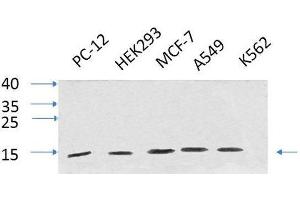 Western Blot analysis of various cells using IL8 Polyclonal Antibody at dilution of 1:1000. (IL-8 Antikörper)