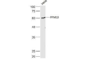 Hela lysates probed with PPM1D Polyclonal Antibody, Unconjugated  at 1:500 dilution and 4˚C overnight incubation.