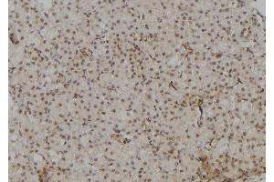 ABIN6264342 and ABIN6277090 at 1/100 staining Rat kidney tissue by IHC-P. (POLR2A/RPB1 Antikörper  (Internal Region))