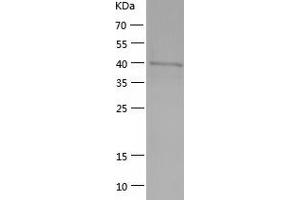 Western Blotting (WB) image for Phosphoglycerate Kinase 1 (PGK1) (AA 1-417) protein (His tag) (ABIN7124417) (PGK1 Protein (AA 1-417) (His tag))
