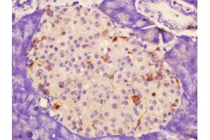 Immunohistochemistry (Paraffin-embedded Sections) (IHC (p)) image for anti-Selectin P (Granule Membrane Protein 140kDa, Antigen CD62) (SELP) (AA 701-768) antibody (ABIN670131)