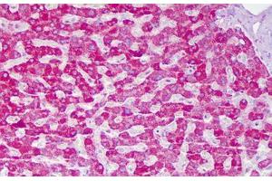 Anti-ACAT1 antibody IHC staining of human liver, hepatocytes. (ACAT1 Antikörper  (AA 221-270))