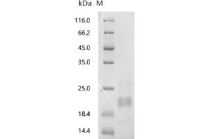 (Tris-Glycine gel) Discontinuous SDS-PAGE (reduced) with 5 % enrichment gel and 15 % separation gel.