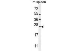 Western Blotting (WB) image for anti-LIM Domain Only 4 (LMO4) antibody (ABIN2995822) (LMO4 Antikörper)