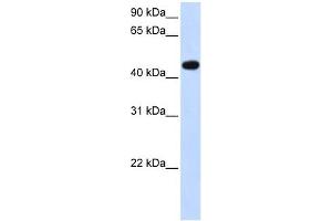 AADAC antibody used at 1 ug/ml to detect target protein. (AADAC Antikörper)