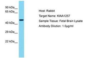 Image no. 1 for anti-Cilia and Flagella Associated Protein 92 (CFAP92) (AA 314-363) antibody (ABIN6750571) (CFAP92/KIAA1257 Antikörper  (AA 314-363))