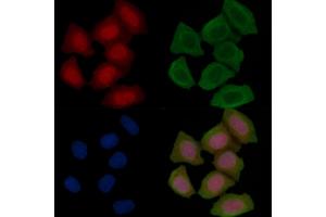 Phospho-Optineurin (Ser177) Antibody staining Hela cells(45 min of heat-shock treatment) by IF/ICC. (OPTN Antikörper  (pSer177))