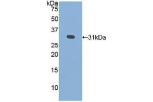 Detection of Recombinant GLa, Human using Polyclonal Antibody to Galactosidase Alpha (GLa) (GLA Antikörper  (AA 147-371))