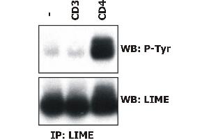 Induction of LIME tyrosine phosphorylation. (LIME Antikörper  (AA 141-295))