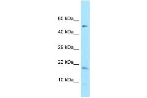 WB Suggested Anti-DAZAP2 Antibody Titration: 1. (DAZAP2 Antikörper  (C-Term))