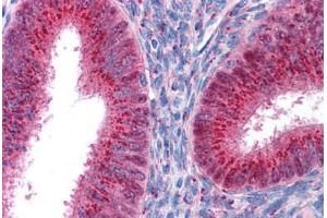 Human Uterus (formalin-fixed, paraffin-embedded) stained with FOXA1 antibody ABIN214751 at 5 ug/ml followed by biotinylated goat anti-rabbit IgG secondary antibody ABIN481713, alkaline phosphatase-streptavidin and chromogen. (FOXA1 Antikörper  (AA 395-444))