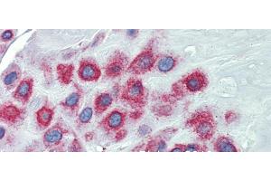 Immunohistochemistry (IHC) image for anti-LIM Domains Containing 1 (LIMD1) (N-Term) antibody (ABIN2784238)