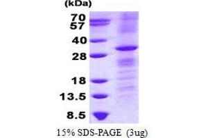 Image no. 1 for Ras Homolog Gene Family, Member V (RHOV) protein (His tag) (ABIN1098671)