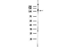 Western blot analysis of lysates from Hela cells(starvation 24h treatment), using Phospho-Transferrin Receptor (Tyr20) Antibody at 1/1000 dilution.