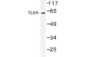 Image no. 1 for anti-Transducin-like Enhancer Protein 4 (TLE4) antibody (ABIN272213) (TLE4 Antikörper)