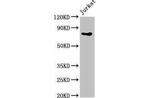 Western Blot Positive WB detected in: Jurkat whole cell lysate All lanes: PIK3R2 antibody at 4 μg/mL Secondary Goat polyclonal to rabbit IgG at 1/50000 dilution Predicted band size: 82 kDa Observed band size: 82 kDa (PIK3R2 Antikörper  (Regulatory Subunit beta))