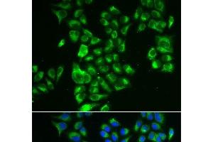 Immunofluorescence (IF) image for anti-Glutamate Dehydrogenase 2 (GLUD2) antibody (ABIN7011241)