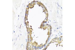 Immunohistochemistry of paraffin-embedded human prostate using SMAD2 antibody (ABIN4905224) at dilution of 1:100 (40x lens). (SMAD2 Antikörper)