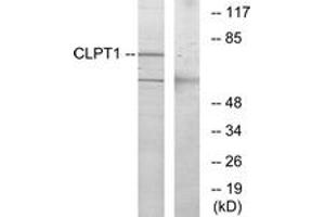 Western blot analysis of extracts from COS7 cells, using CLPT1 Antibody. (CLPTM1 Antikörper  (AA 200-249))