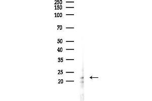 anti-Dual Specificity Phosphatase 14 (DUSP14) (Internal Region) antibody