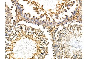 ABIN6259032 and ABIN6275010 at 1/100 staining Rat testis tissue by IHC-P.