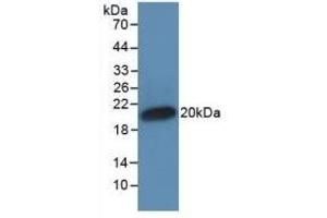 Detection of Recombinant IFNa, Human using Monoclonal Antibody to Interferon Alpha (IFNa) (IFNA Antikörper  (AA 24-181))