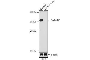 Western blot analysis of extracts from normal (control) and Cyclin D3 knockout (KO) HeLa cells, using Cyclin D3 antibody (ABIN6127731, ABIN6138087, ABIN6138088 and ABIN7101345) at 1:1000 dilution. (Cyclin D3 Antikörper  (AA 201-292))