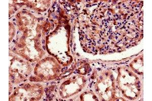 Immunohistochemistry of paraffin-embedded human kidney tissue using ABIN7172838 at dilution of 1:100 (TGFBRAP1 Antikörper  (AA 401-600))