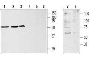 Western blot analysis of Jurkat (lanes 1 and 4), HL-60 (lanes 2 and 5), MCF-7 (lanes 3 and 6) and rat brain (lanes 7 and 8) lysates: - 1,2,3,7. (KISS1R Antikörper  (3rd Extracellular Loop))