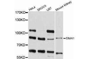 Western blot analysis of extracts of various cell lines, using DNAI1 antibody (ABIN6291702) at 1:1000 dilution.