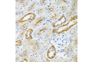 Immunohistochemistry of paraffin-embedded rat kidney using  antibody (ABIN6129960, ABIN6136680, ABIN6136681 and ABIN6224707) at dilution of 1:100 (40x lens). (AIFM3 Antikörper  (AA 1-200))
