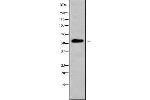 Western blot analysis of MOT6 using HepG2 whole cell lysates (SLC16A5 Antikörper  (Internal Region))