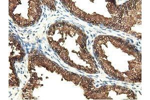Immunohistochemical staining of paraffin-embedded Human liver tissue using anti-EPHX2 mouse monoclonal antibody. (EPHX2 Antikörper)