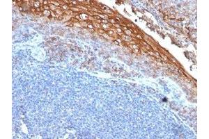 Formalin-fixed, paraffin-embedded human tonsil stained with CD146 antibody (MUC18/1130) (MCAM Antikörper)