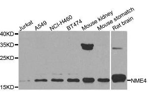 Western blot analysis of extracts of various cell lines, using NME4 antibody. (NME4 Antikörper  (AA 1-187))