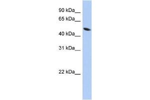 WB Suggested Anti-ZNF793 Antibody Titration:  0. (ZNF793 Antikörper  (Middle Region))