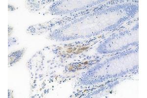 ABIN6256263 and ABIN6267434 at 1/100 staining human normal colon tissue by IHC-P. (Synaptotagmin Antikörper  (pSer309))