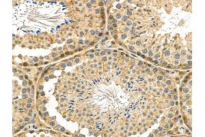 ABIN6260917 and ABIN6278560 at 1/100 staining Mouse testis tissue by IHC-P.